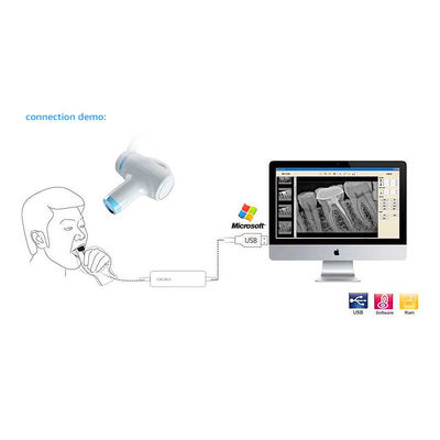 Handheld портативная зубоврачебная камера машины x Рэй для Endodontic обработки